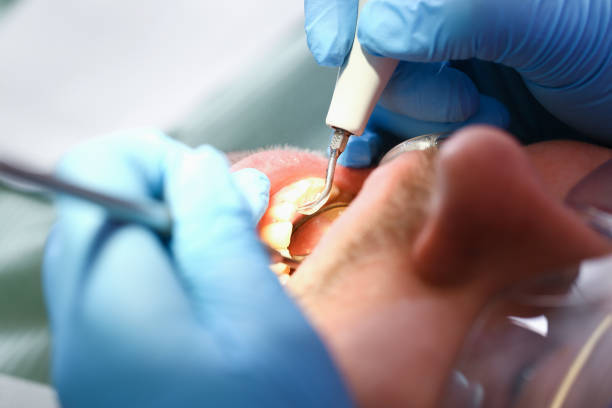 Best Weekend Emergency Dentist in Listoga, CA