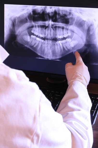 Best Emergency Dentist for Knocked-Out Tooth in Listoga, CA