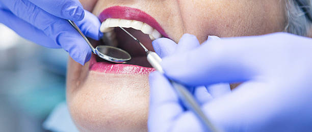 Best Emergency Dental Care for Abscessed Tooth in Listoga, CA